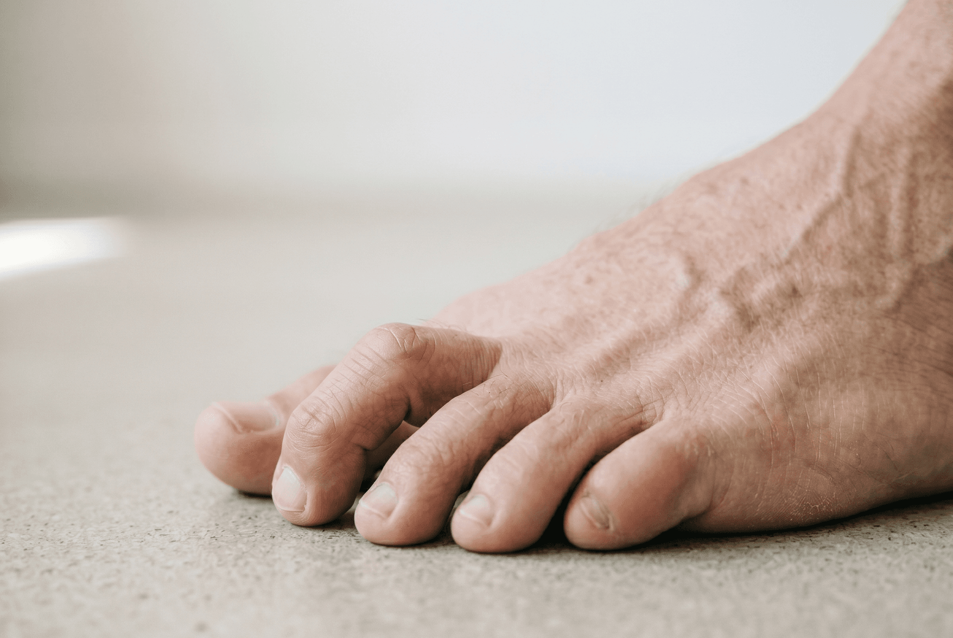 Hammer toe — orthopaedic correction